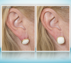 Set of Two Goldtone Magic Bax Earring Lifters by Lori Greiner