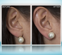 Set of Two Goldtone Magic Bax Earring Lifters by Lori Greiner